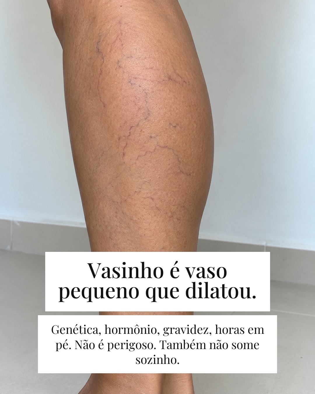 A foto que você apagou — card 3