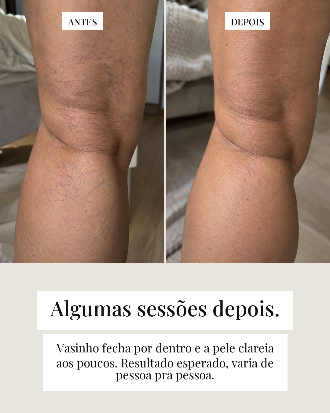 A foto que você apagou — card 7